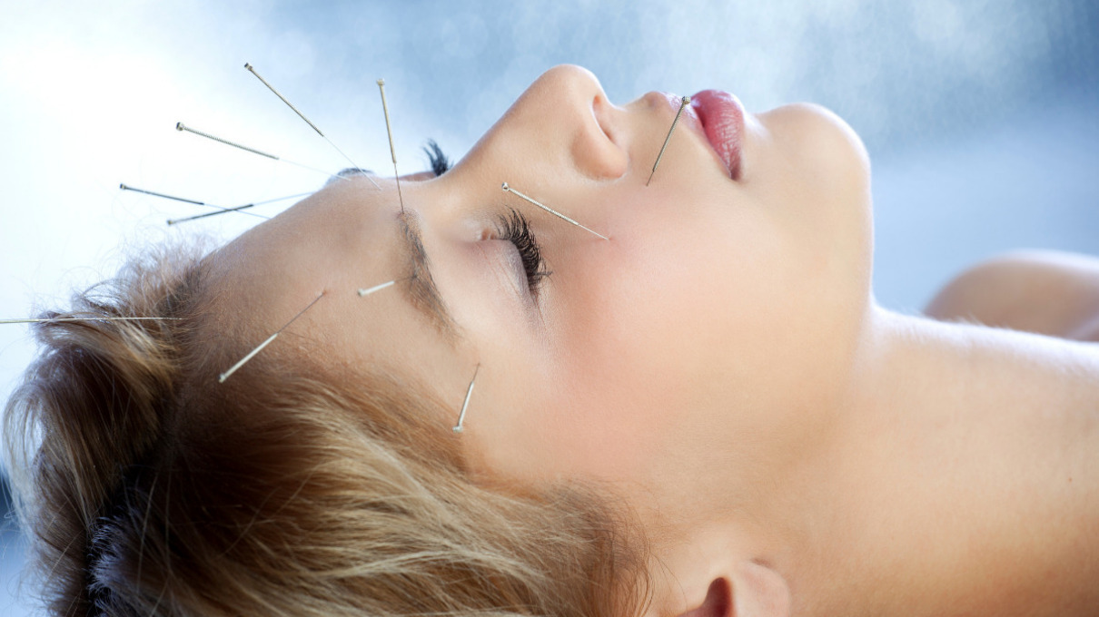 Acupuntura facial para rejuvenecer